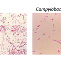 Bacilles à Gram négatif pathogènes autre