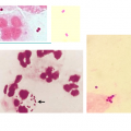 Cocci à  Gram négatif