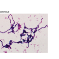 Streptococcus