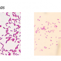 Pseudomonas