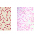 Haemophilus