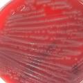 Escherichia coli sur gélose au sang