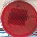 Escherichia coli hémolytique