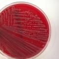 Escherichia coli
