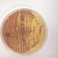 Escherichia coli sur milieu chromogénique