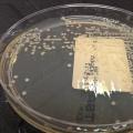 Klebsiella pneumoniae