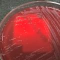 Staphylococcus epidermidis (1)
