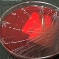 Staphylococcus epidermidis (2)