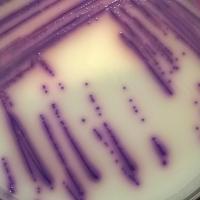 Salmonella sur milieu chromogène