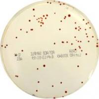 Campylobacter sur milieu chromogénique