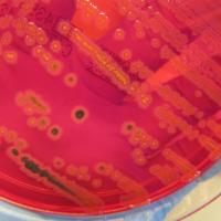 Salmonella sur XLD